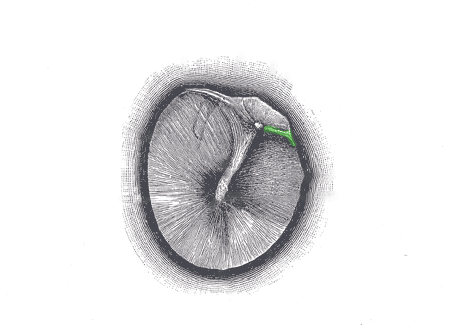 tympanic membrane anatomy - anterior malleollar fold